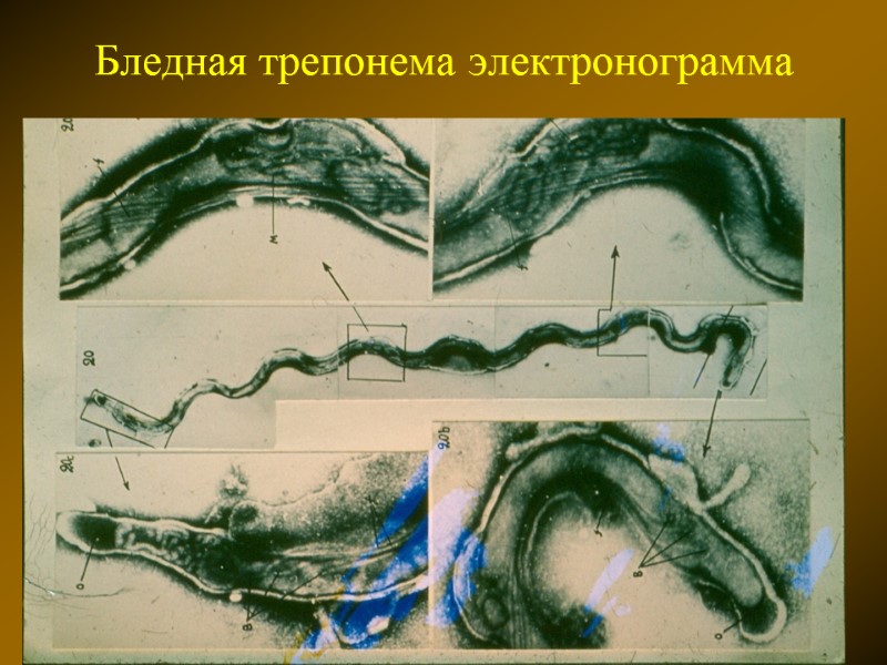 Бледная трепонема электронограмма
